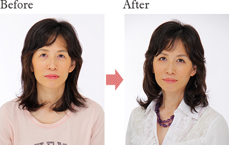 before after